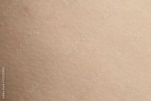 Foto Texture of normal skin as background, closeup