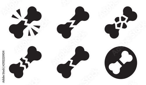 Schilderij op canvas Set of broken bone icons showing different types of fractures and severity levels