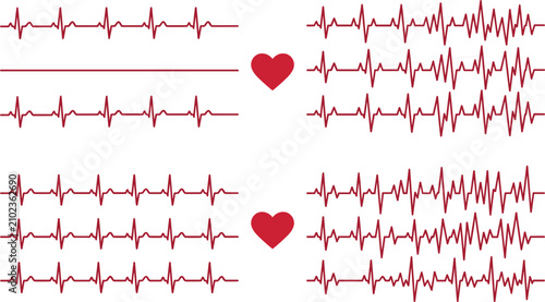 Electrocardiogram ECG Heartbeat Pulse Waveform Vector Bundle Featuring Normal Rhythms Arrhythmia Tachycardia and Flatline Diagrams for Medical Monitoring Concepts
