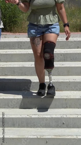 Young woman with a prosthetic leg and tattoos walking down concrete stairs. Her partner is holding her hand, supporting her recovery