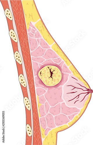 Close-up of female breast with clock tattoo. Medical illustration of breast anatomy and time concept.