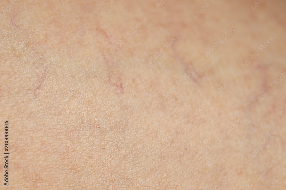 Fototapeta premium Texture of normal skin as background, closeup