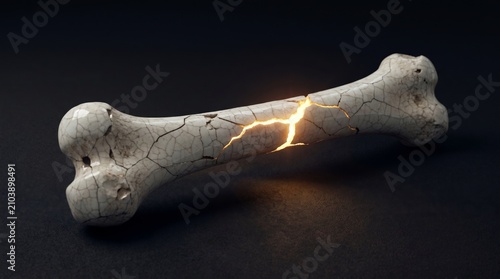 Broken human bone with glowing fracture. Medical concept of skeletal injury, osteoporosis or trauma. Osteology and orthopedics study of bone health, pain and fracture recovery diagnostic.