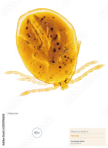 Konstfotografi Hard ticks are parasites that attach to a host; their bites are painless, and they can transmit bacterial, protozoal, and viral diseases such as Lyme disease, encephalitis, and tularemia