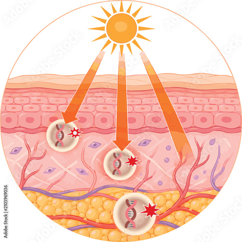 Fotografía Ultraviolet UV rays penetrating skin layers causing DNA damage cells flat vector