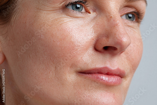 Close up skin texture, dry skin flakes, facial pores, mature woman cheek, natural complexion, blue eye