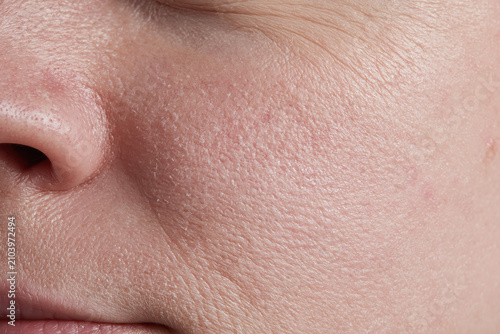 Close up macro of slightly dry facial skin flakes on cheek with visible pores, texture and subtle redness conveying natural skin detail and gentle vulnerability