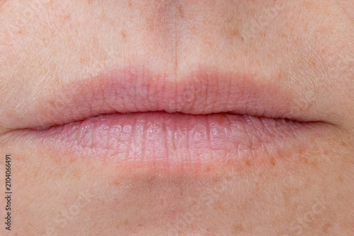 Photos Lip wrinkle running across the lip surface that accentuate the natural texture o