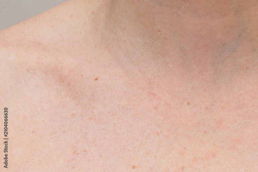 Fototapeta premium Skin with Freckles and Subtle Pigmentation on the Neck and Shoulder
