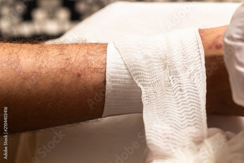Doctor's gloved hand applying a sterile gauze bandage to a patient's injured leg
