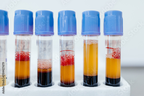 Blood samples in collection tubes after centrifugation for clinical laboratory diagnostics, blood analysis, hematology testing and biomedical research