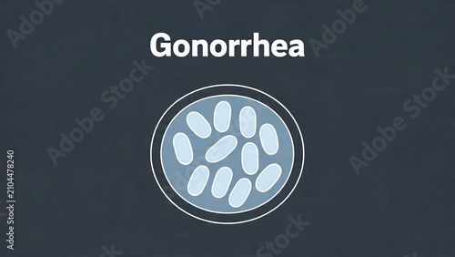 Gonorrhea bacteria illustration and text on a dark grey background