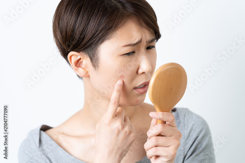 Foto 顔のにきびに悩む女性