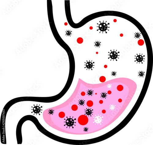 Stomach infection illustration with virus and bacteria cells medical concept