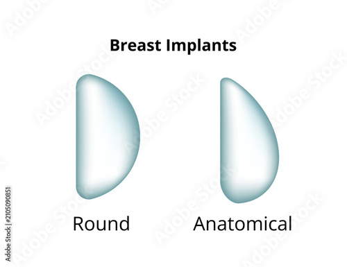 Breast implants comparing round and anatomical shapes