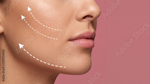 Face cheek jawline skin lifting beauty Facial skin lifting concept with cheek and jawline close up, cosmetic treatment arrows