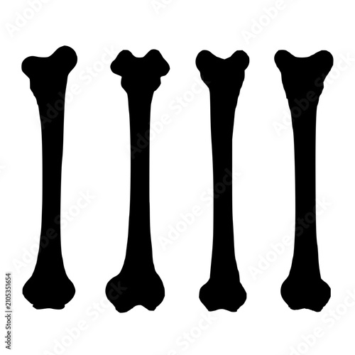 Femur bone anatomy progression set with monochromatic vector silhouettes and detailed shading featuring bone structure, skeletal system, and anatomical study with clean lines and white background