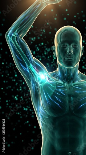 Lesión por esfuerzo repetitivo en el hombro; visualización médica en 3D de la parte superior del cuerpo humano con el brazo levantado.