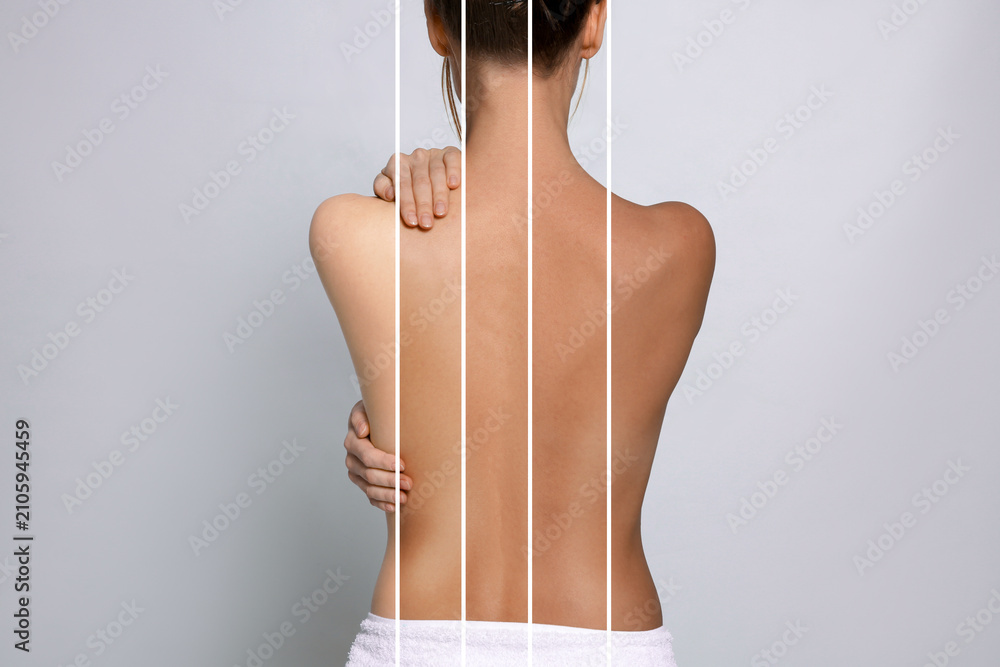 © New Africa - Levels of tanning. Collage showing woman with various skin tones on grey background, closeup