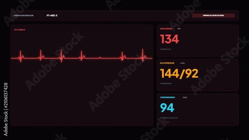 Medical Heart Rate Monitor Display with Red ECG Line Graph Showing High Pulse and Elevated Blood Pressure Numbers for Patient Vital Signs Tracking UI HUD Graphic Loop Animation