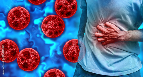 Obraz na plátně Cyclosporiasis disease outbreak as a foodborne parasitic illness caused by Cyclospora cayetanensis as an outbreak with contaminated food or water resulting in explosive diarrhea and digestive illness