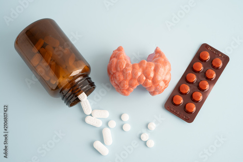 Thyroid model with pill drug treatment, Hyperthyroidism, Overactive or Lymphoma.