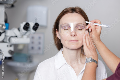Fotografie Modern Blepharoplasty Procedure with Eyelid Marking for Surgery
