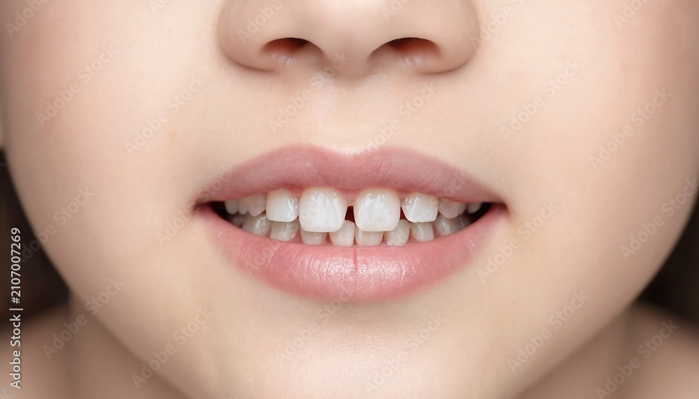 Obraz premium Close up shot of a young child smiling showing natural baby teeth and small gap