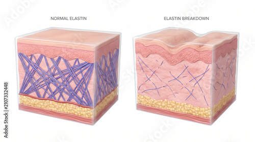 3D Skin Block Diagram Showing Normal Elastin and Breakdown
