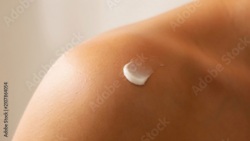 A small dab of white moisturizing cream on a persons shoulder