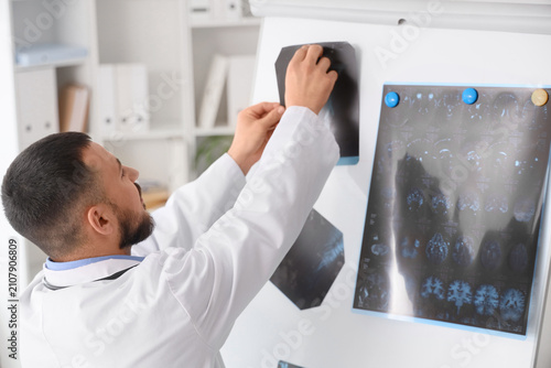 Male doctor putting x-ray s...