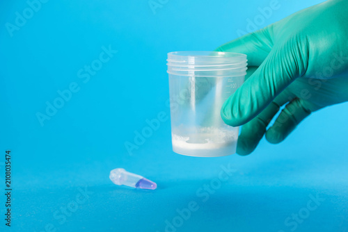 Photos A doctor holds a medical container with ejaculate in his hand against a blue background