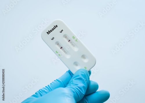 Blood  sample of patient negative result for measle virus.