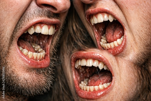 A couple with their mouths agape in shock or surprise, potentially due to an unexpected event