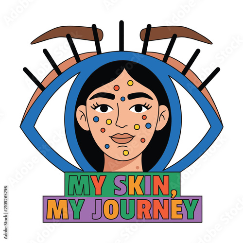 Skin positivity vector illustration of a woman's face with acne inside a large eye with the slogan 'My Skin, My Journey'