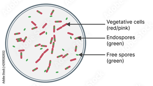Cuadro en lienzo Endospore Staining Result Showing Vegetative Cells, Endospores and Free Spores U