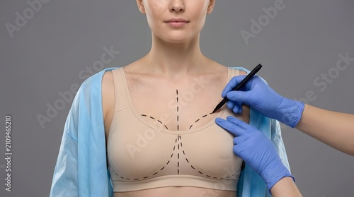 Surgical planning for breast augmentation marking lines on a patient's chest