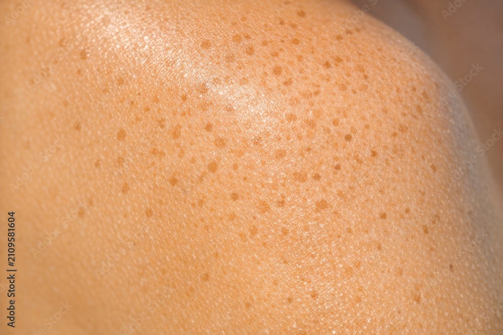 Fototapeta premium Close-up of human skin featuring freckles, great for beauty or health-related uses