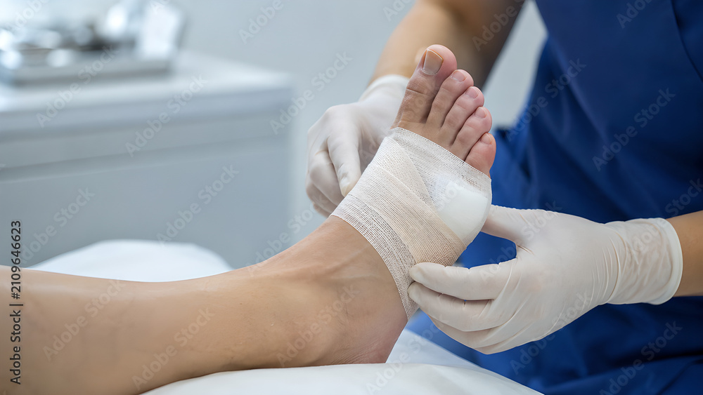 Fototapeta premium Bunion big toe with first MTP joint deviation during clinical podiatry examination, photorealistic medical procedure image for healthcare education, orthopedic care, and patient communication