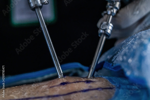Photos Detalhes cirurgia