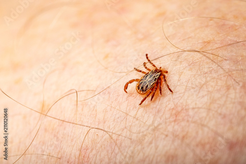 Foto gulf coast tick (Amblyomma maculatum) Attached to Human Skin Close Up