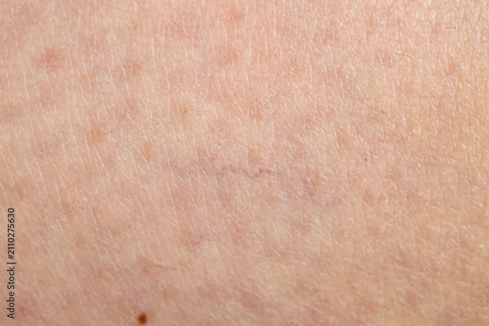 Fototapeta premium Texture of normal skin as background, closeup