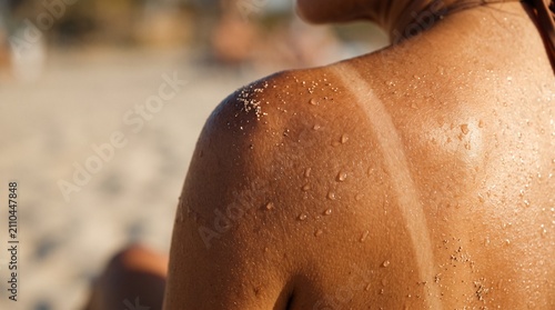 Close up view of sun tanned skin with distinct tan lines and water droplets on shoulder after a sunny day at the beach
