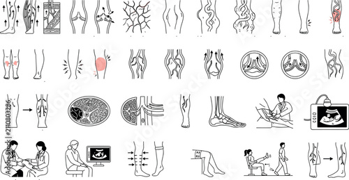 Foto Varicose veins medical line icons set for leg health designVaricose veins medica