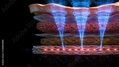 Advanced futuristic technology illustrating layered skin tissue with blue energy beams and red light signals interaction