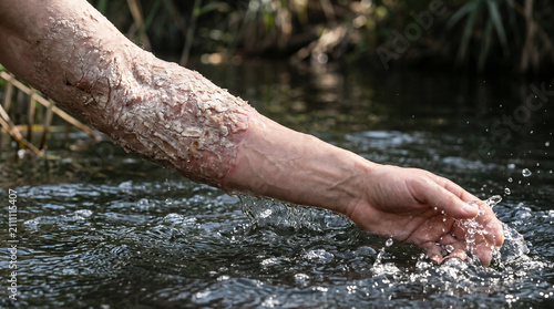 The Syrian commander Naaman miraculously healed of leprosy after dipping himself seven times in the muddy Jordan River