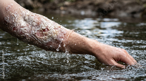 The Syrian commander Naaman miraculously healed of leprosy after dipping himself seven times in the muddy Jordan River
