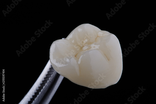 High-quality zirconia dental crown on white background. Dental ceramic crown professional dental lab