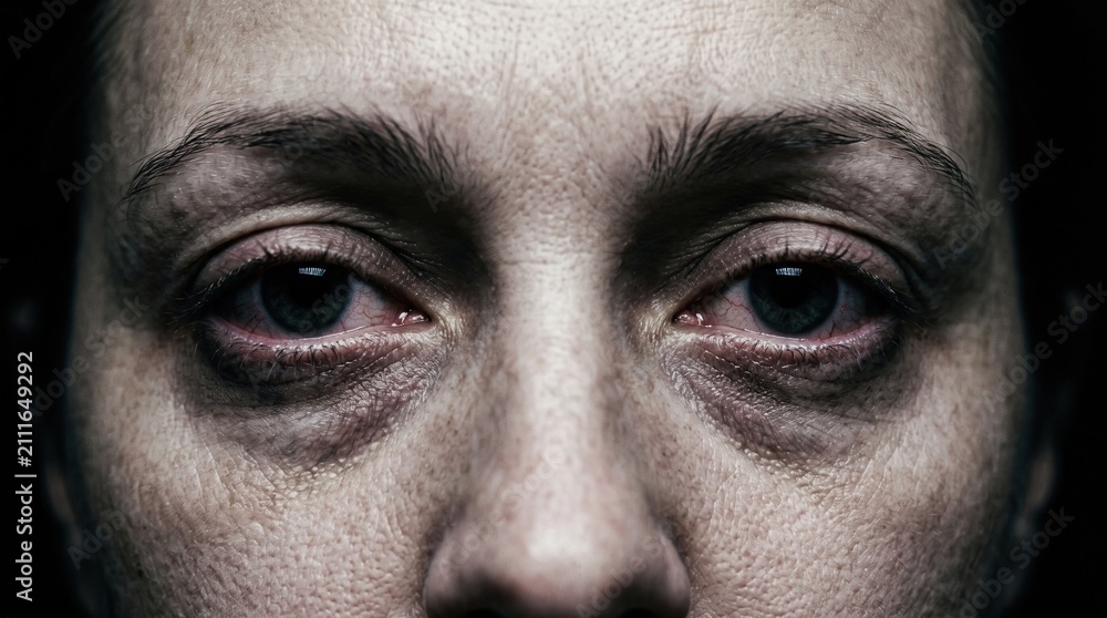 Naklejka premium Close-Up of Tired Woman Eyes with Dark Circles and Bloodshot Sclera