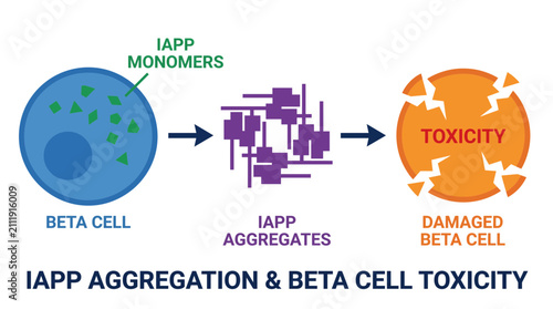 Принти на полотні Islet Amyloid Polypeptide IAPP Aggregation Beta Cell Toxicity
